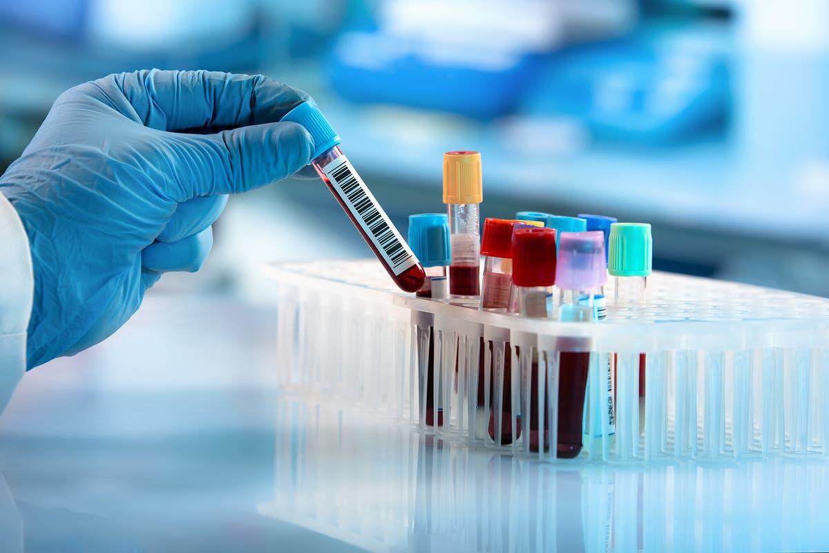 examenes de sangre laboratorio guayaquil